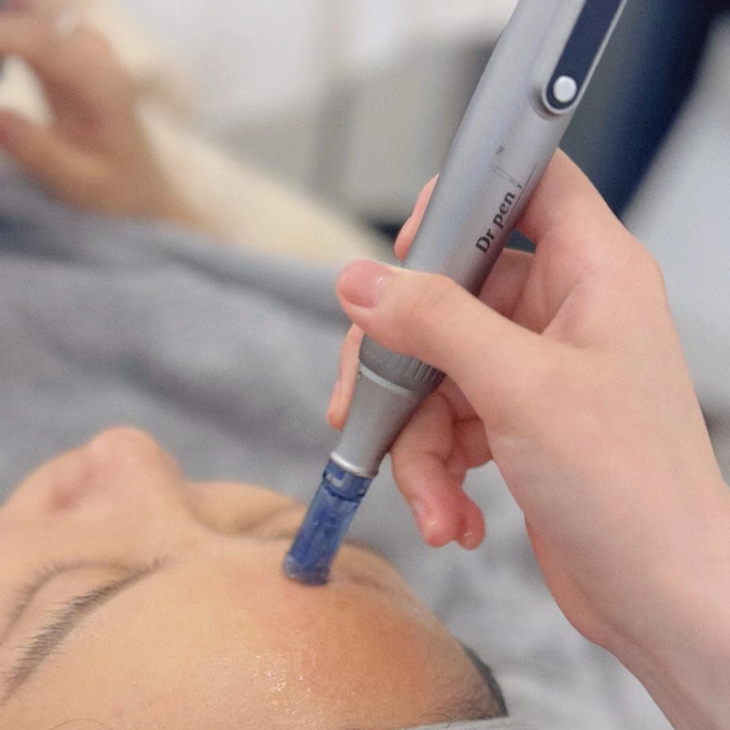 FDA-cleared-microneedling-device-dr-pen